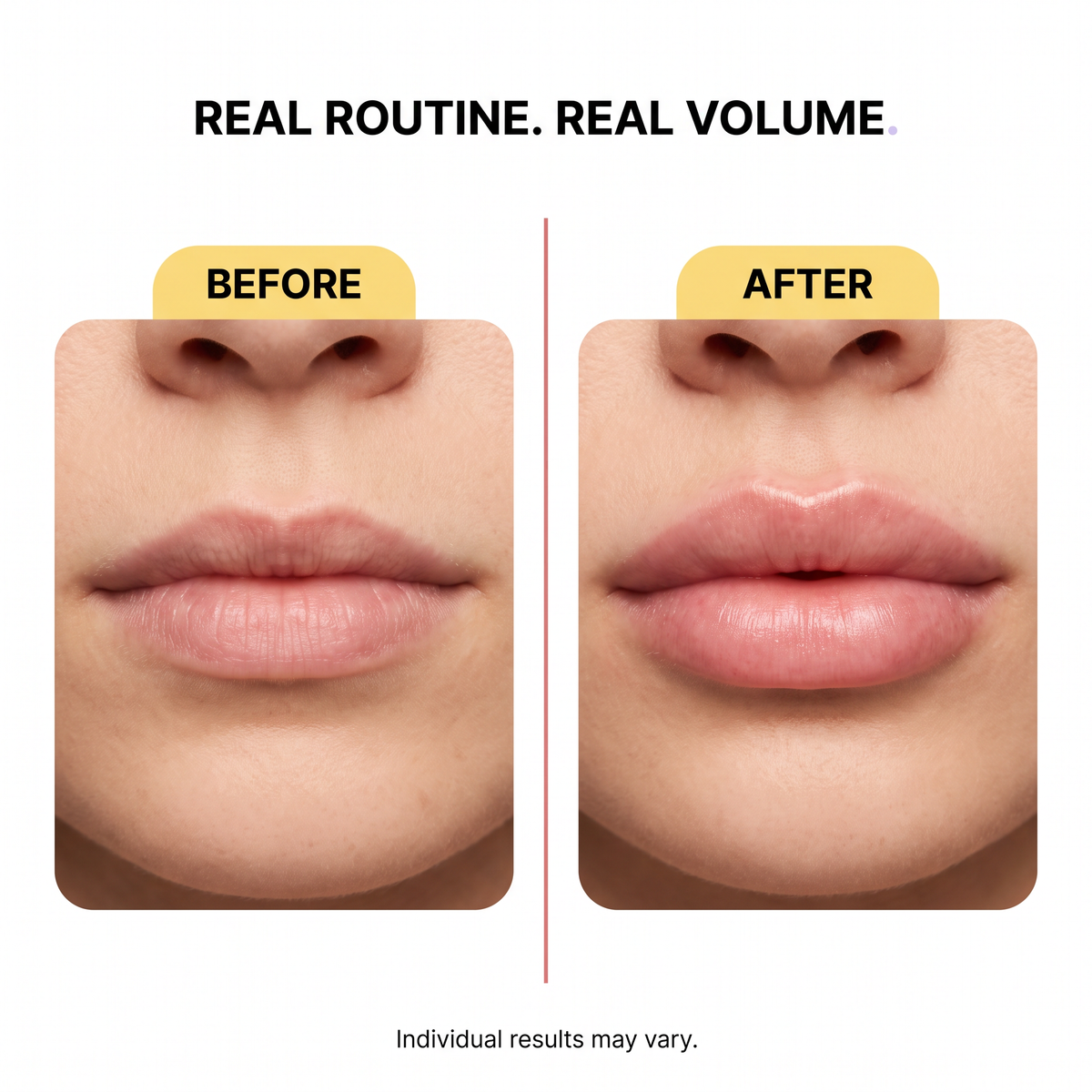 The Juicy Lip Kit